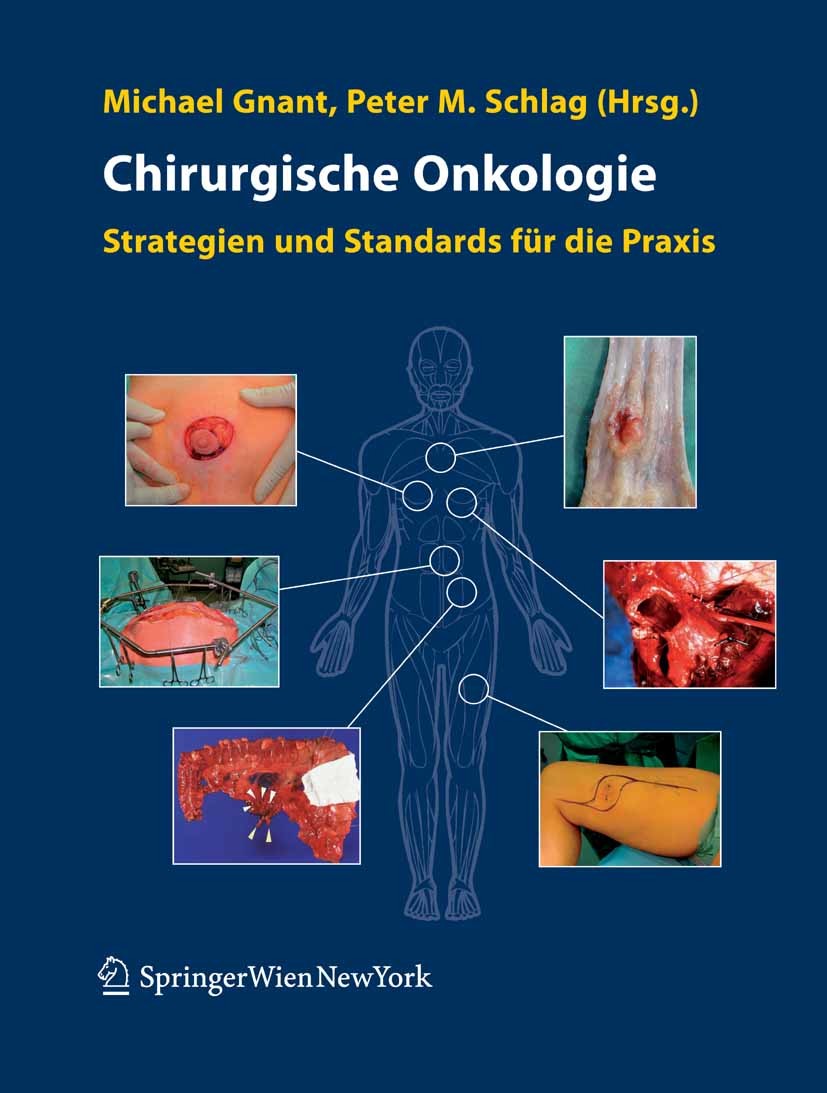 Cover Chirurgische Onkologie