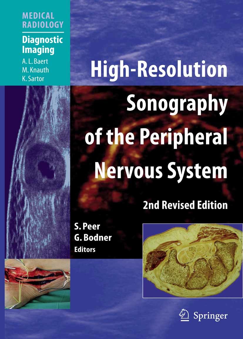 High-Resolution Sonography of the Peripheral Nervous System