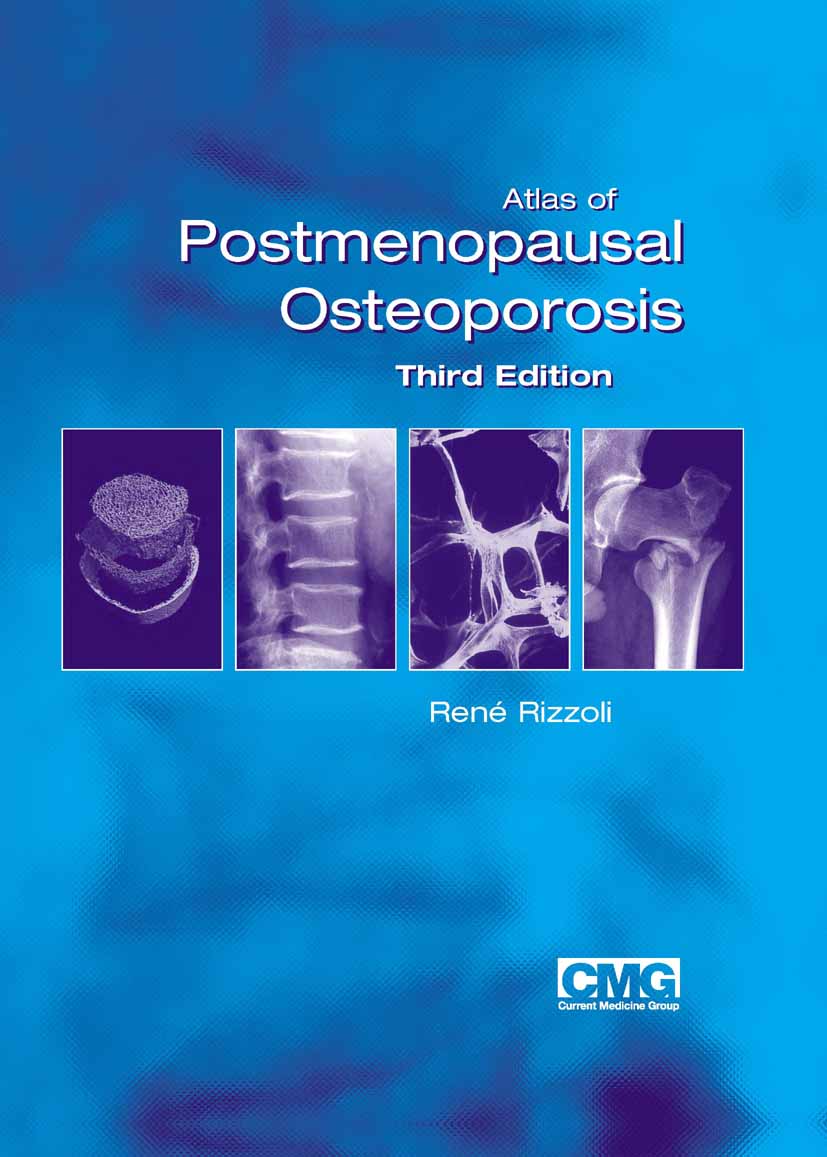 Cover Atlas of Postmenopausal Osteoporosis