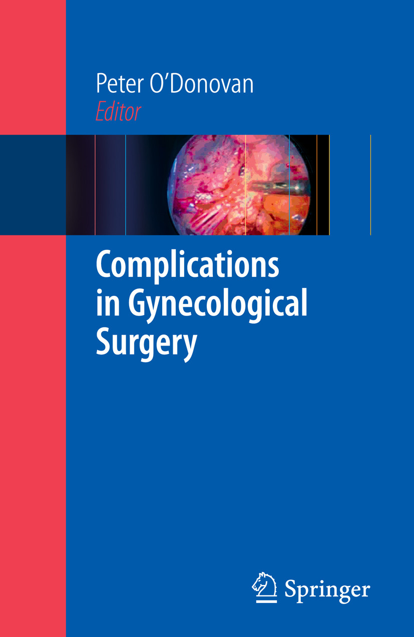 Complications in Gynecological Surgery EBook frohberg