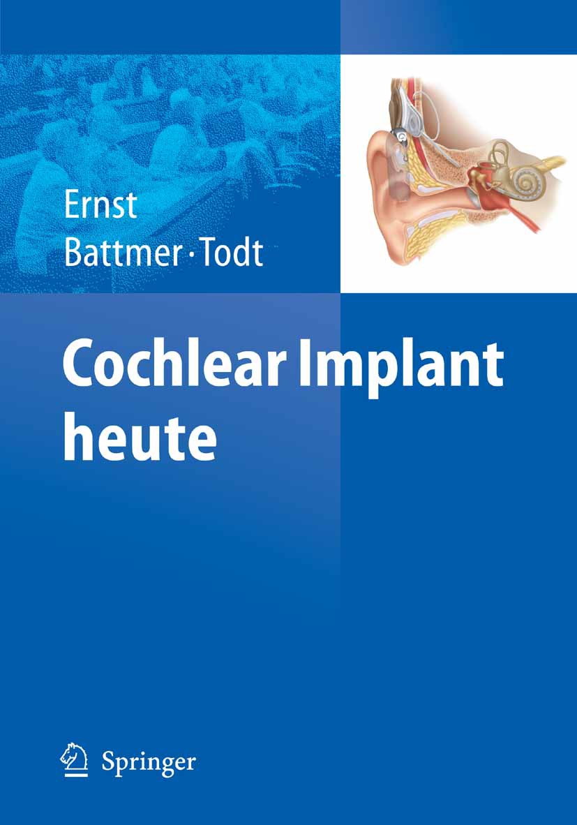 Cover Cochlear Implant heute