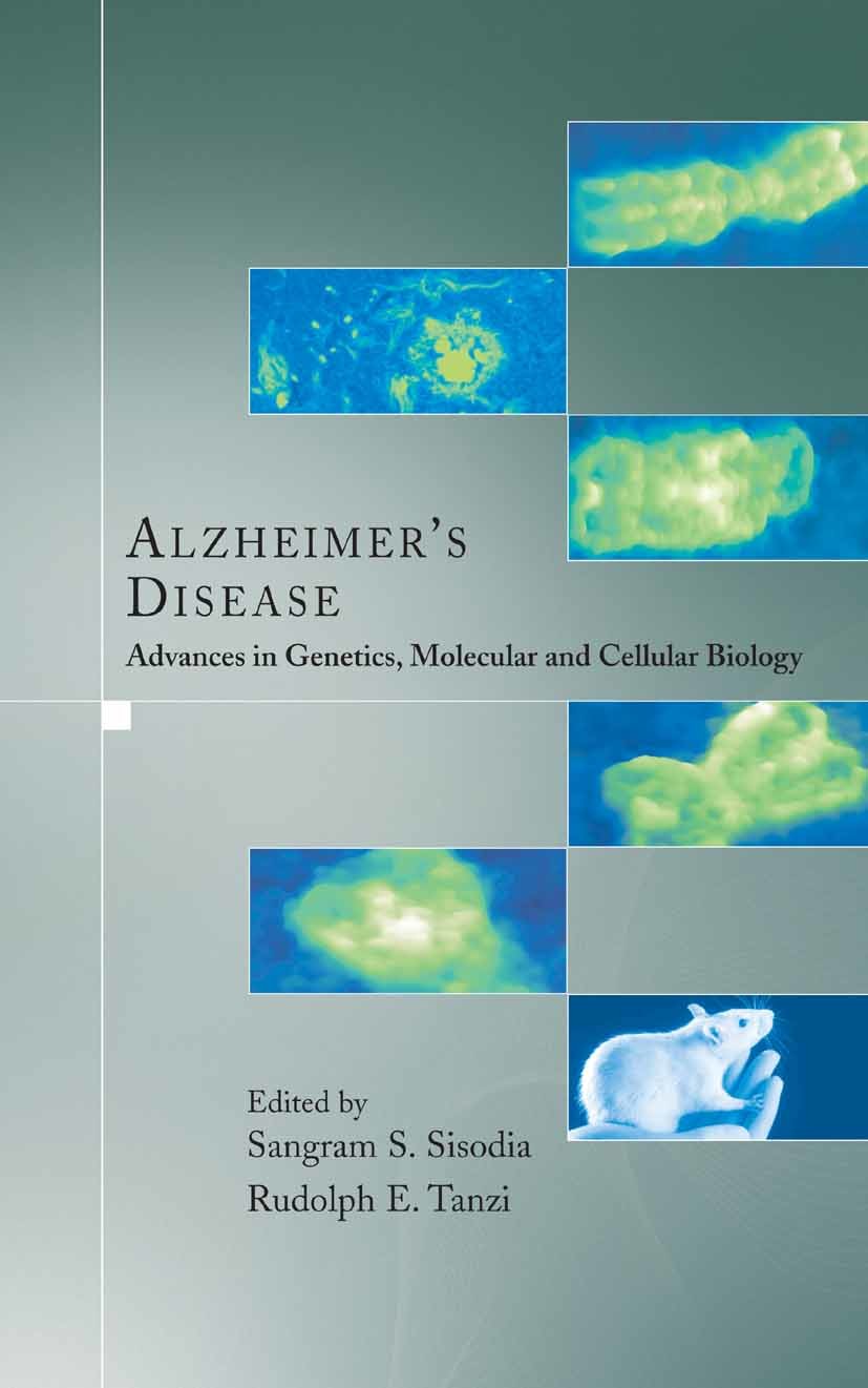 Alzheimer's Disease