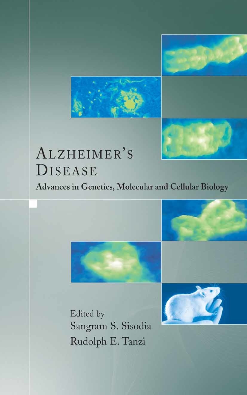Cover Alzheimer's Disease
