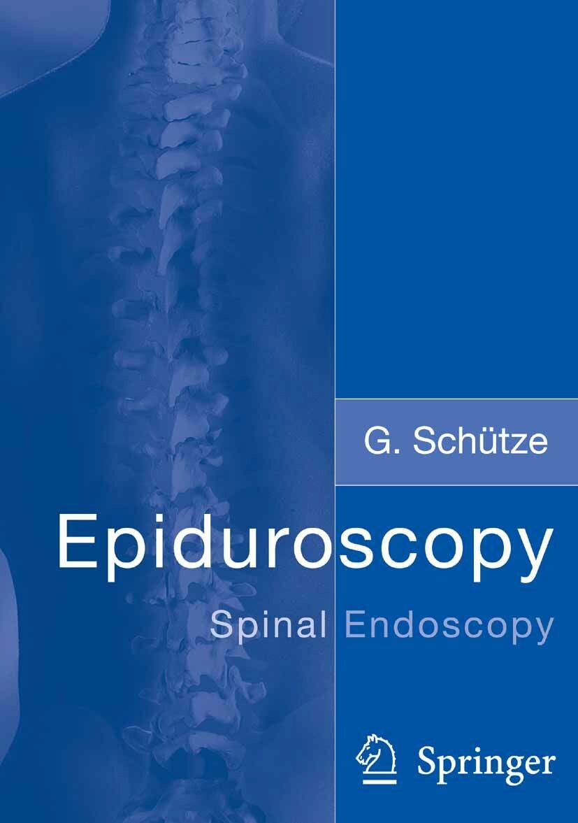 Cover Epiduroscopy