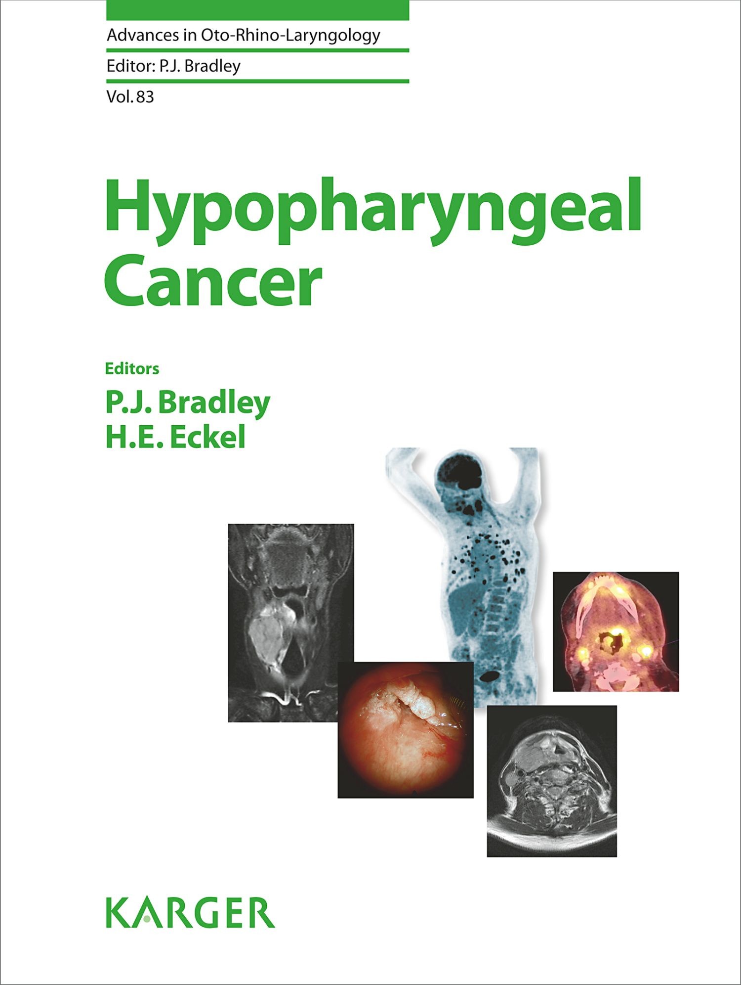 Cover Hypopharyngeal Cancer