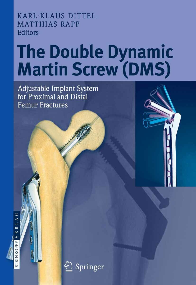 Cover The Double Dynamic Martin Screw (DMS)