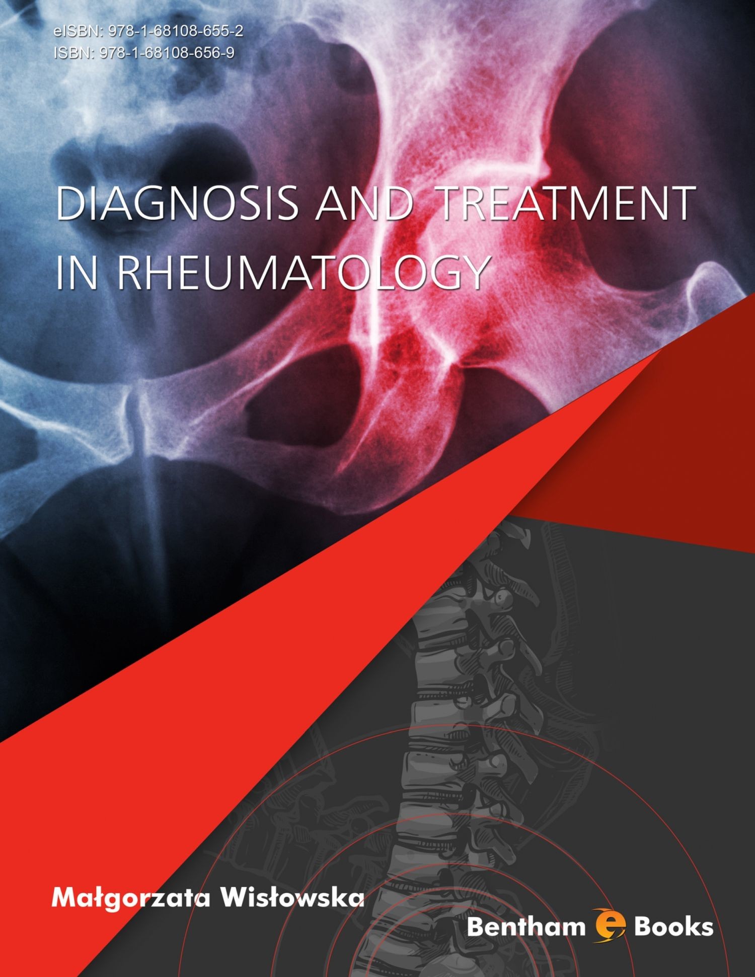 Cover Diagnosis and Treatment in Rheumatology