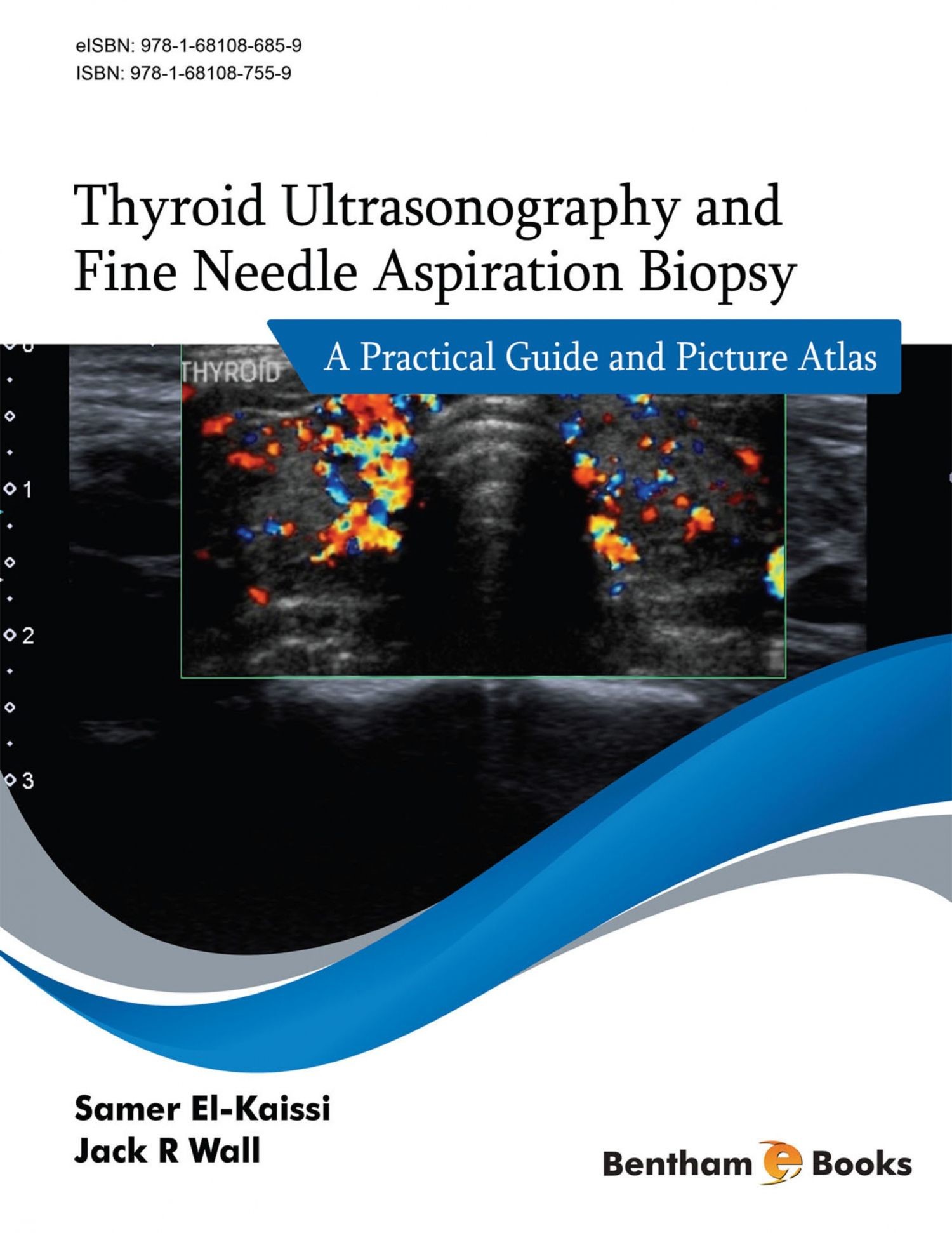 Cover Thyroid Ultrasonography and Fine Needle Aspiration Biopsy: A Practical Guide and Picture Atlas