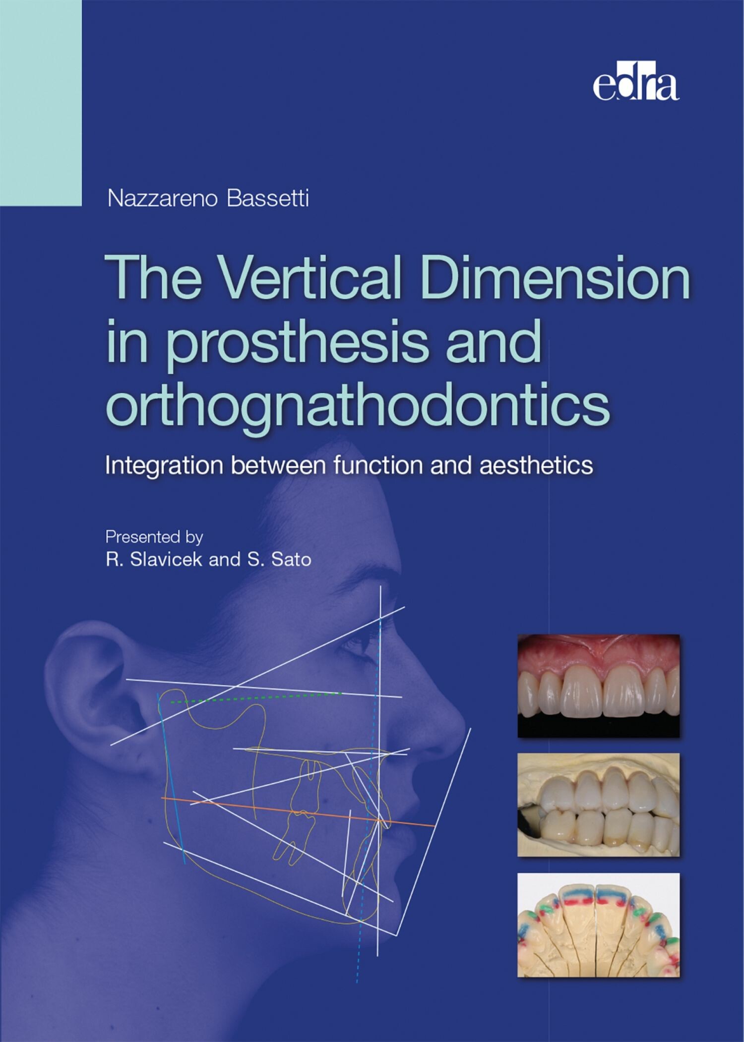 The Vertical Dimension in Prosthetis and Orthognathodontics.