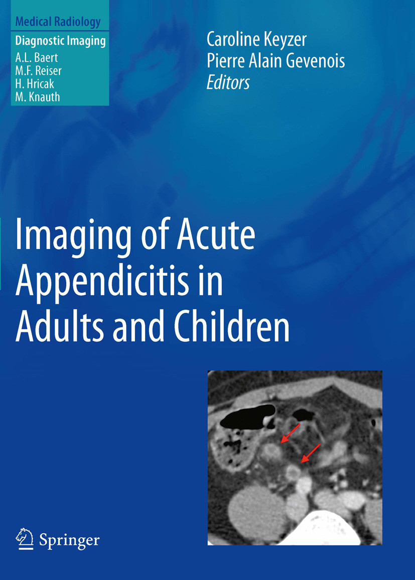 Cover Imaging of Acute Appendicitis in Adults and Children
