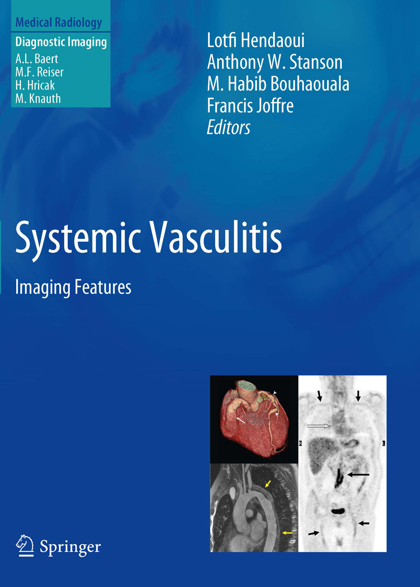 Cover Systemic Vasculitis