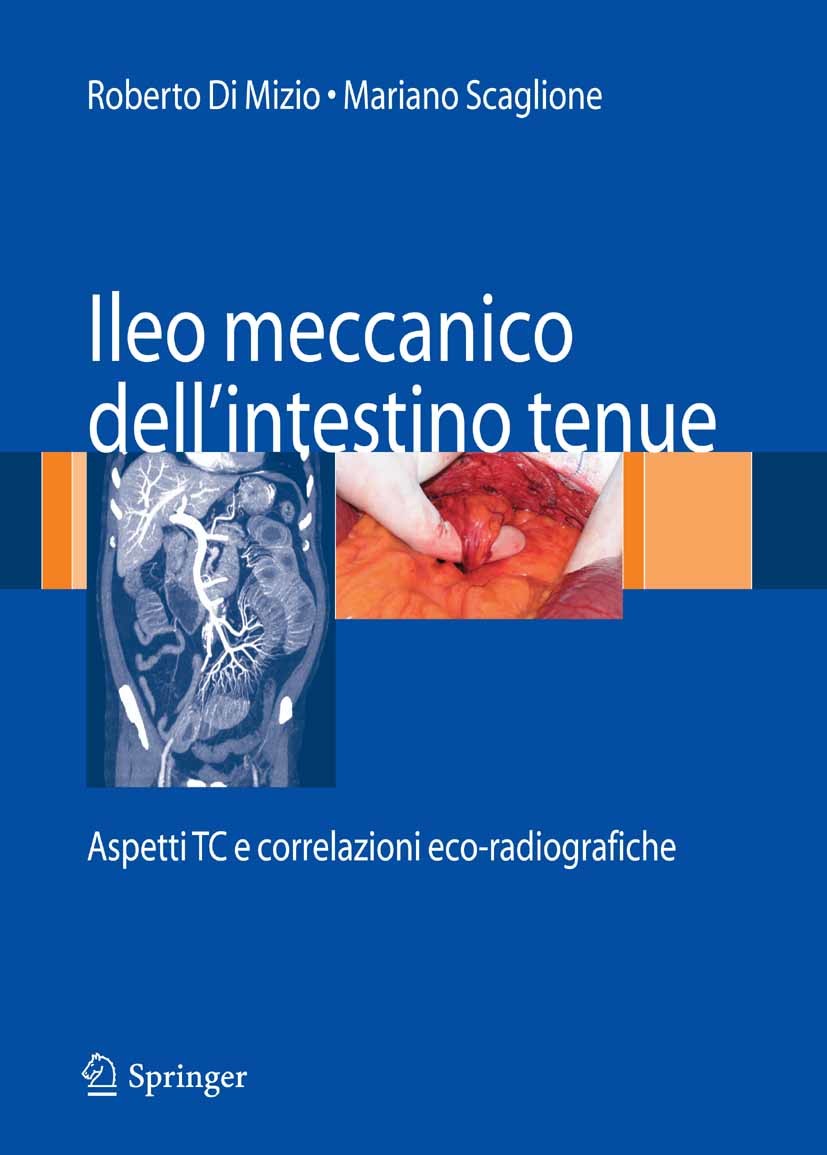 Cover Ileo meccanico dell'intestino tenue