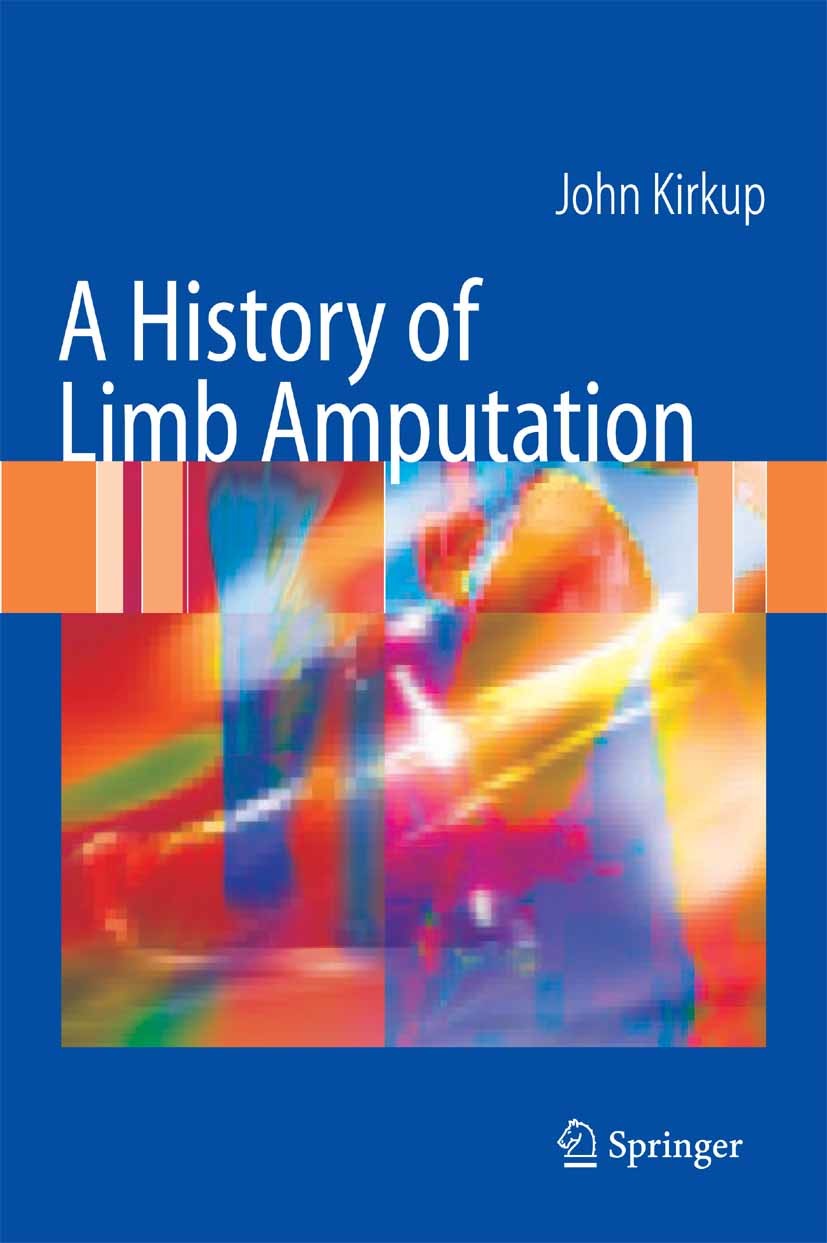 Cover A History of Limb Amputation