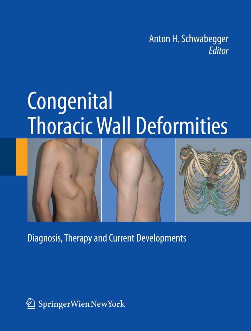 Cover Congenital Thoracic Wall Deformities