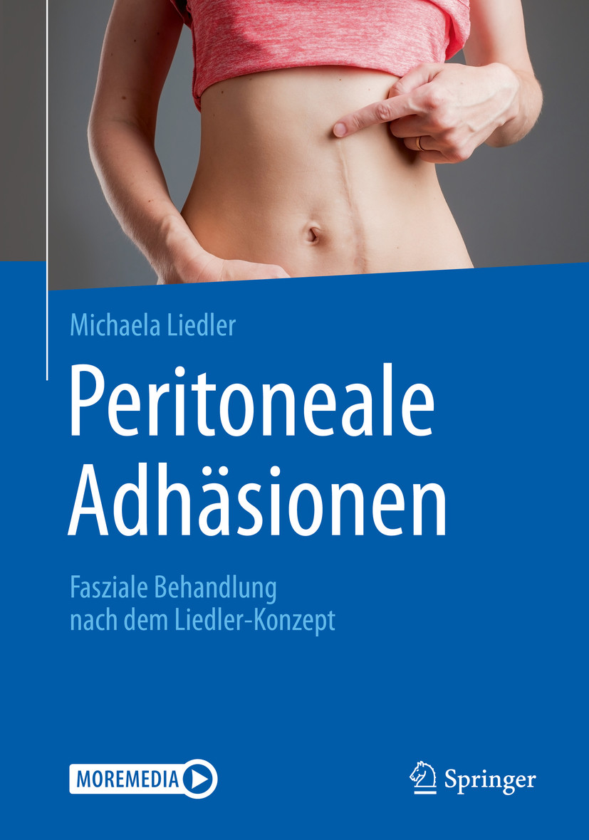 Cover Peritoneale Adhäsionen