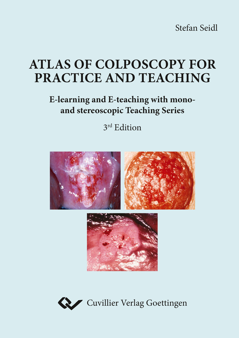 Atlas of Colposcopy for Practice and Teaching