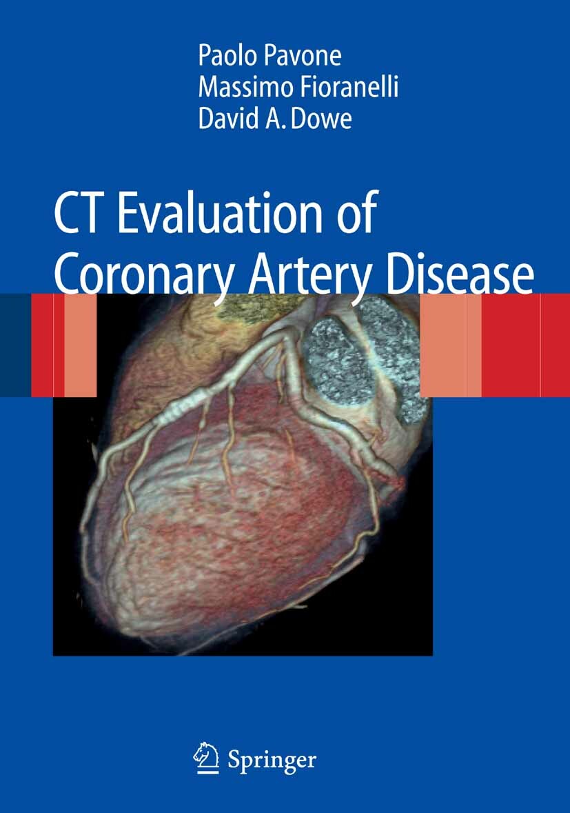 Cover CT Evaluation of Coronary Artery Disease