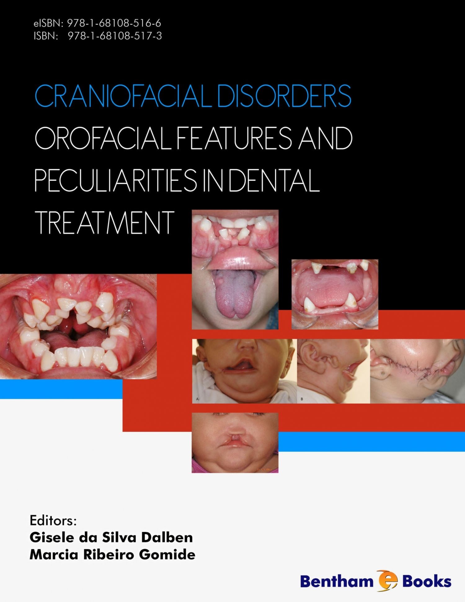 Cover Craniofacial Disorders - Orofacial Features and Peculiarities in Dental Treatment
