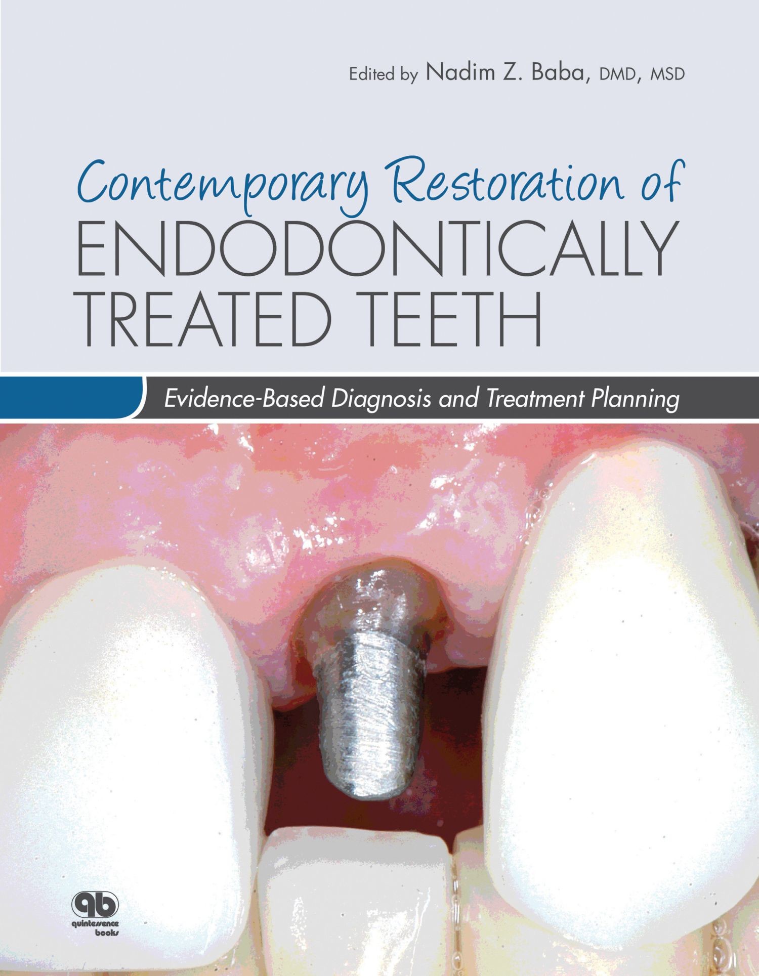 Contemporary Restoration of Endodontically Treated Teeth EBook