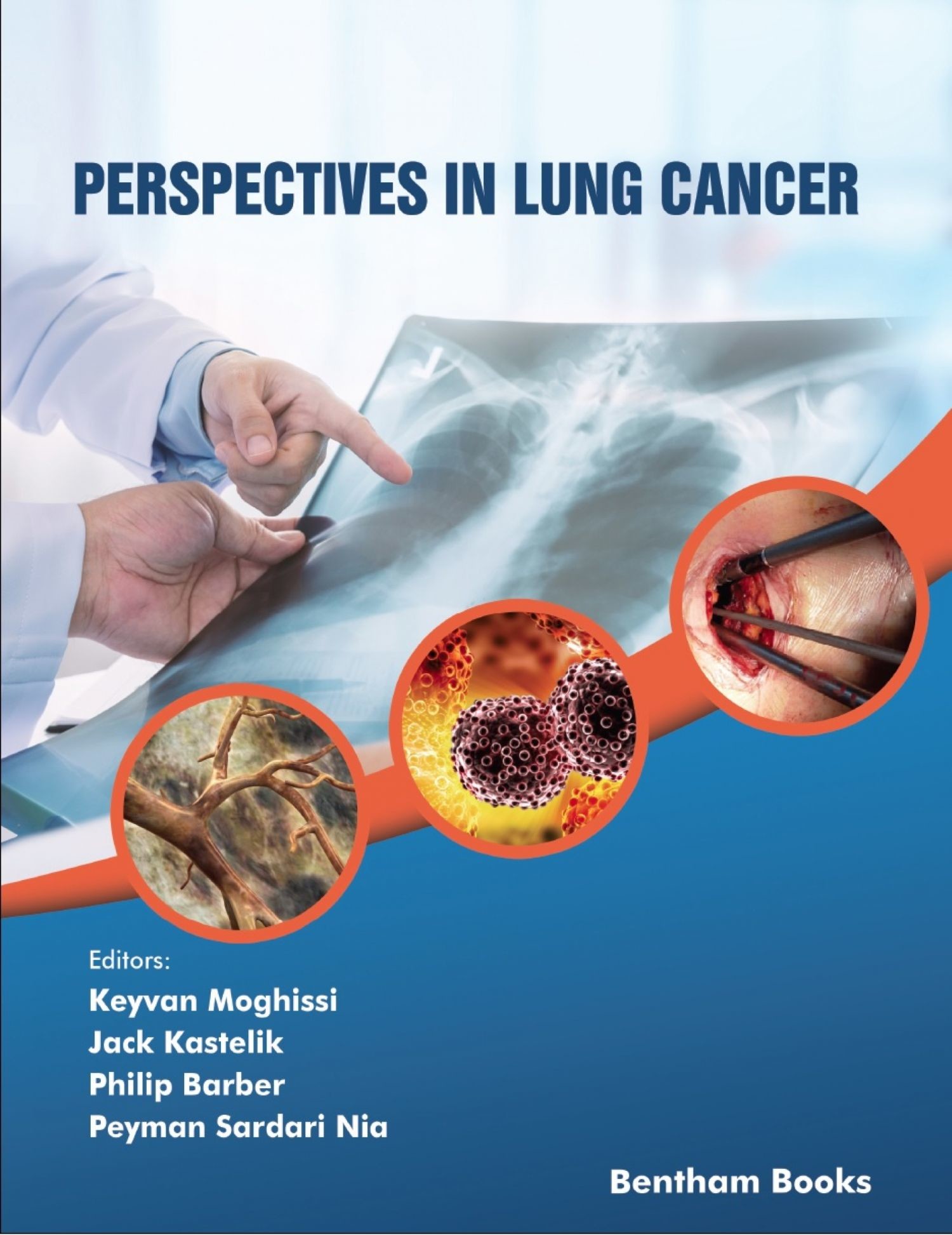 Cover Perspectives in Lung Cancer