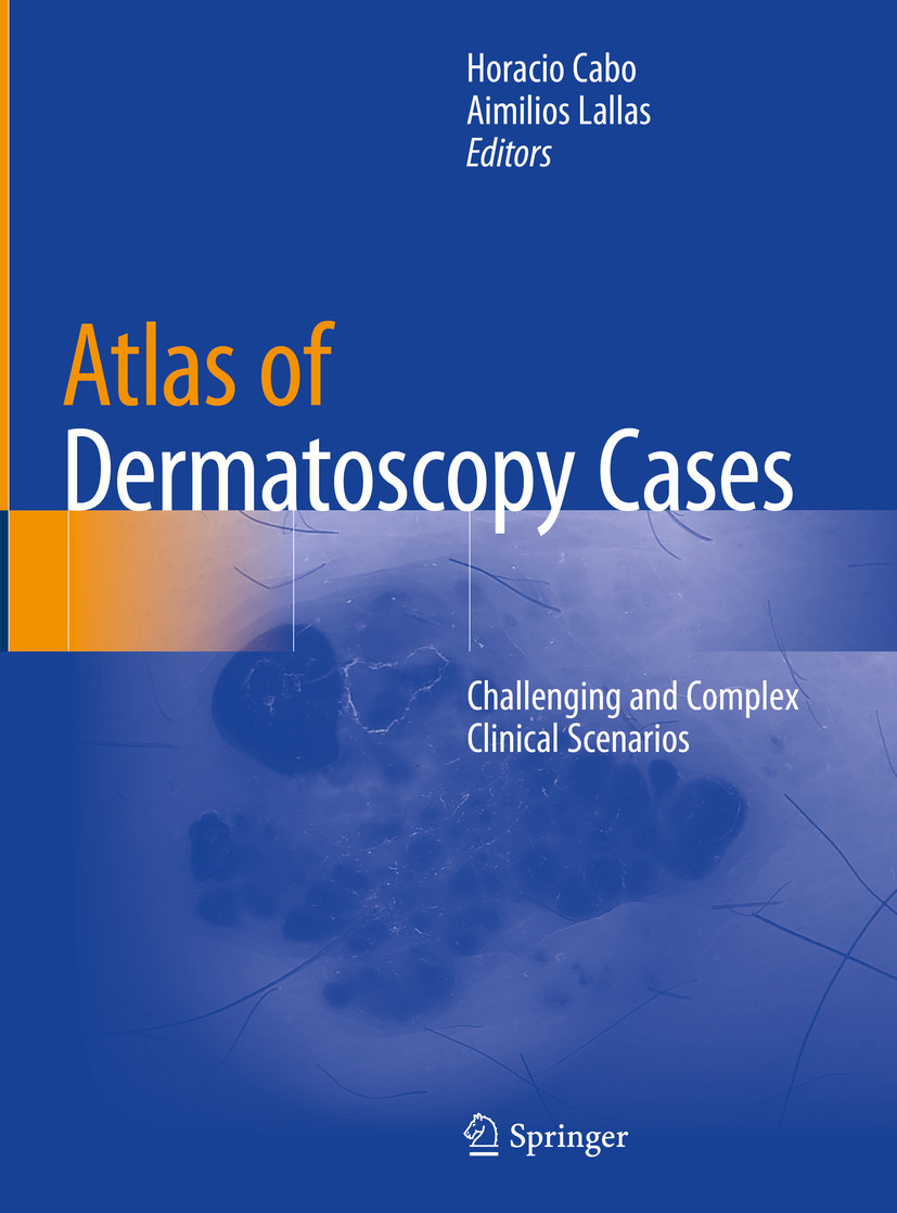 Cover Atlas of Dermatoscopy Cases