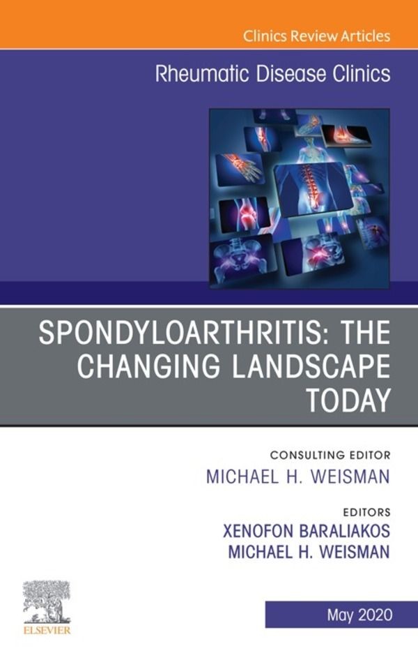 Spondyloarthritis: The Changing Landscape Today, An Issue of Rheumatic Disease Clinics of North America, E-Book