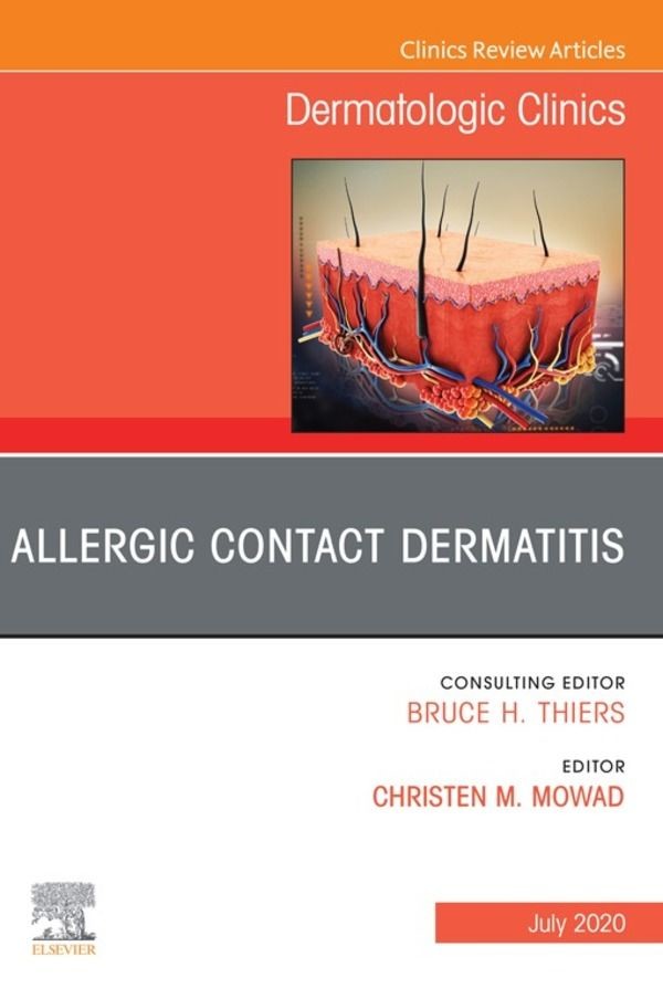 Allergic Contact Dermatitis,An Issue of Dermatologic Clinics -  E-Book