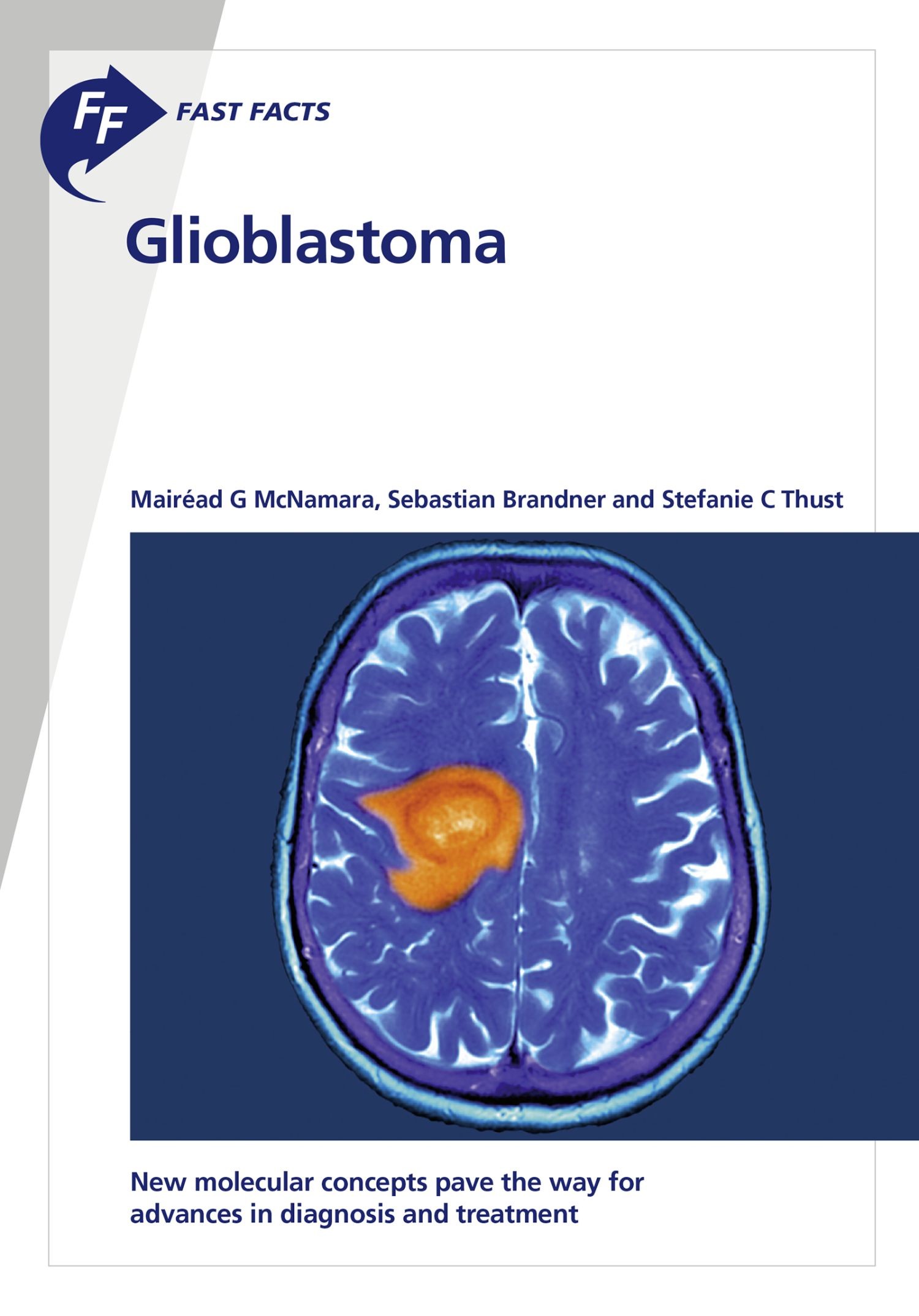 Cover Fast Facts: Glioblastoma