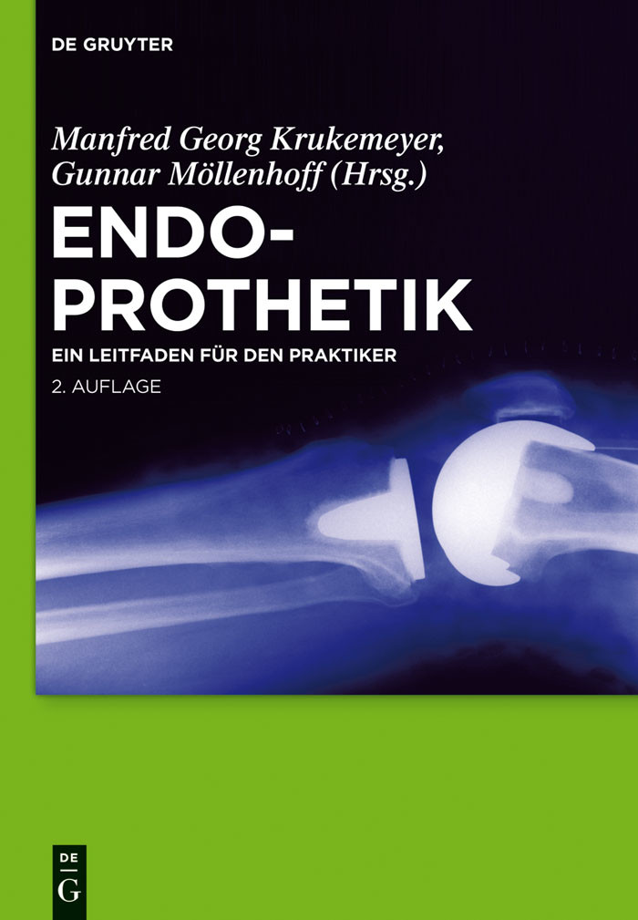 Cover Endoprothetik