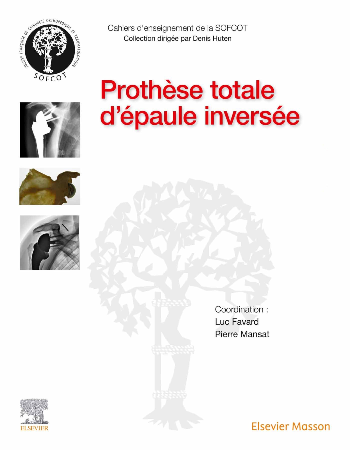 Cover Prothèse totale d'épaule inversée