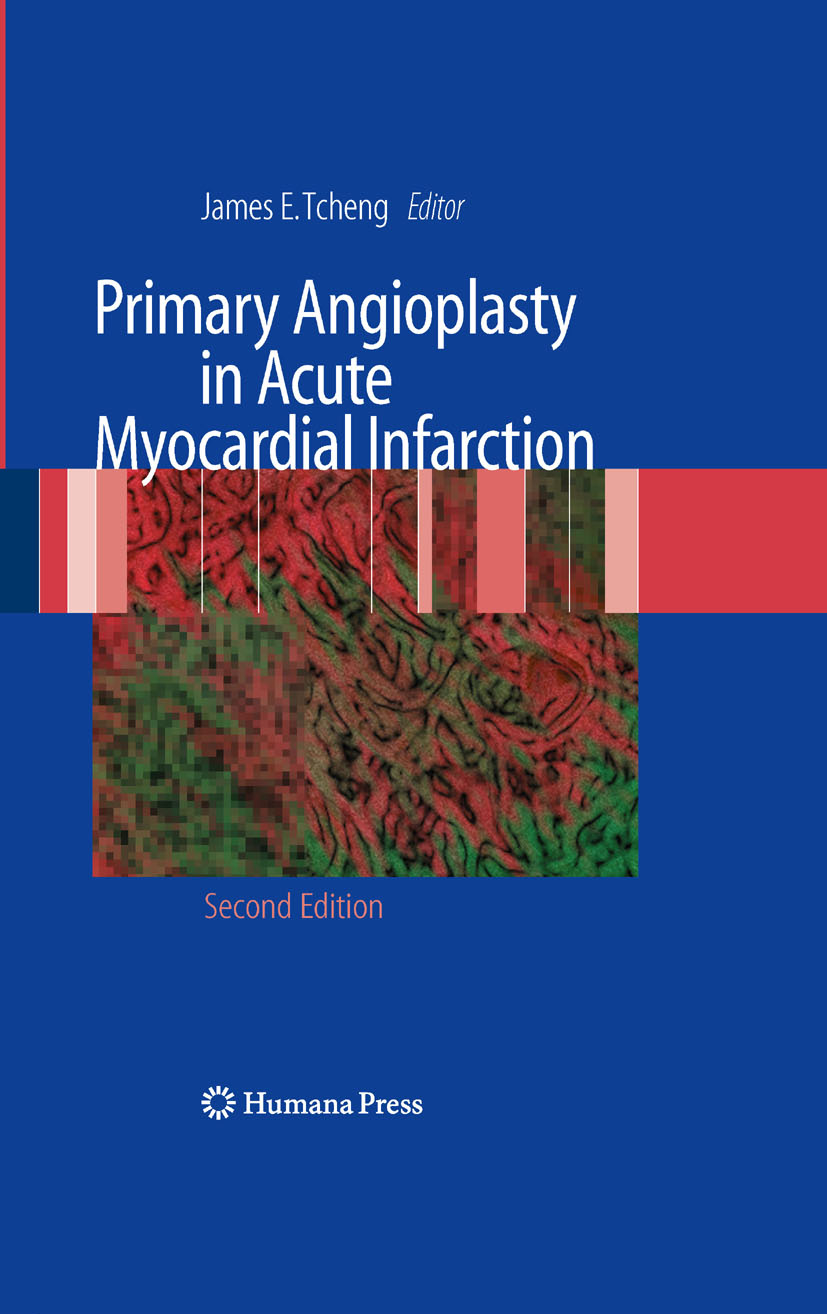 Cover Primary Angioplasty in Acute Myocardial Infarction