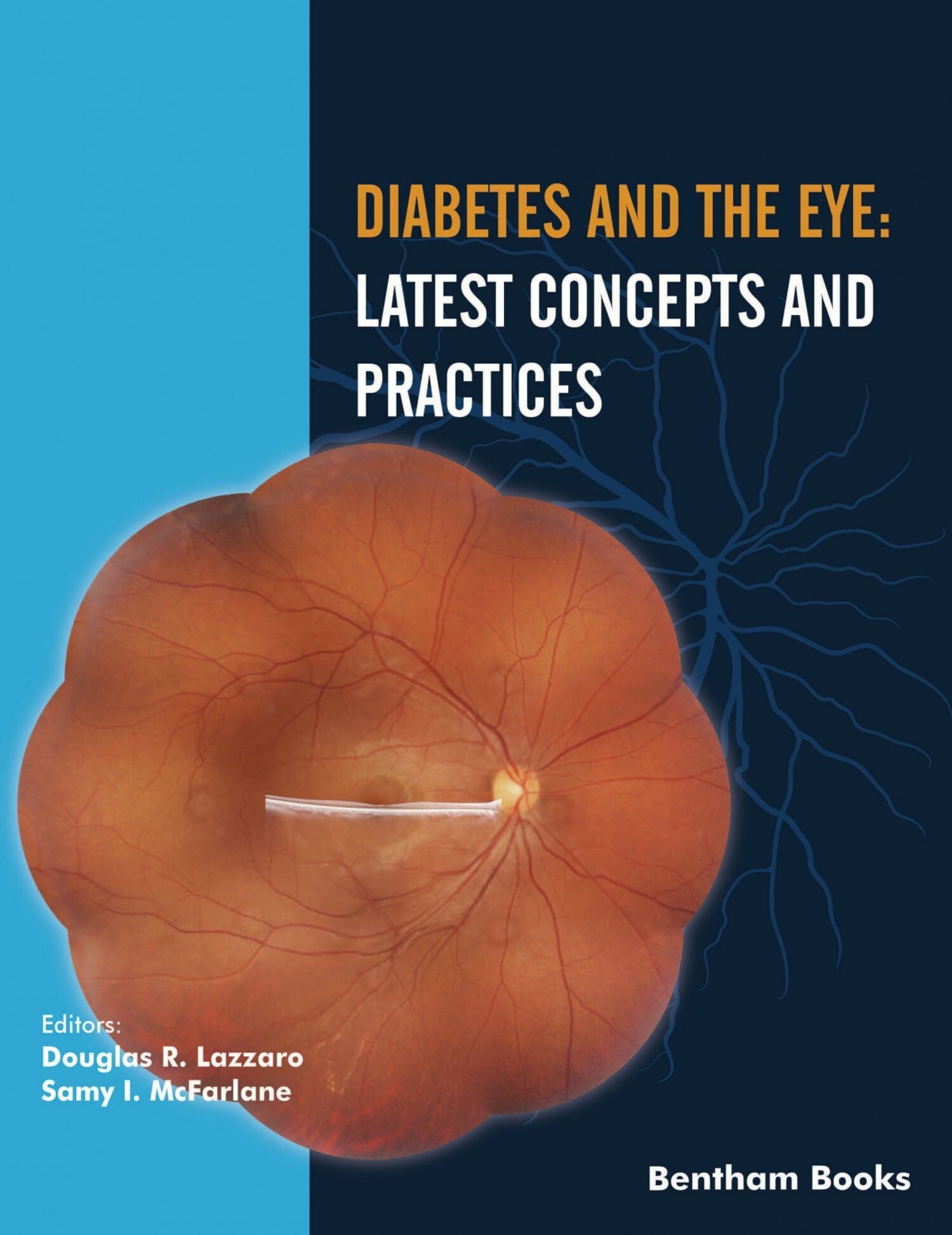 Cover Diabetes and the Eye: Latest Concepts and Practices