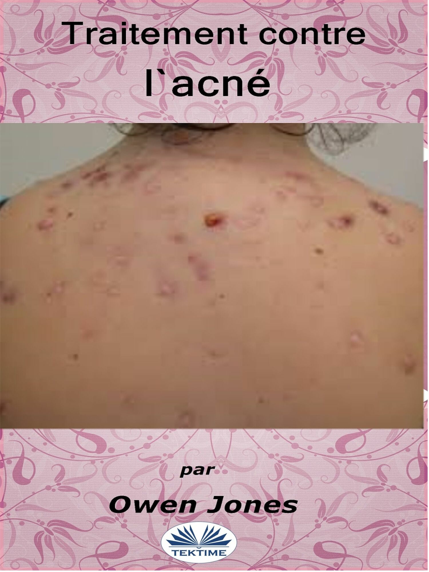 Cover Traitement Contre L'Acné