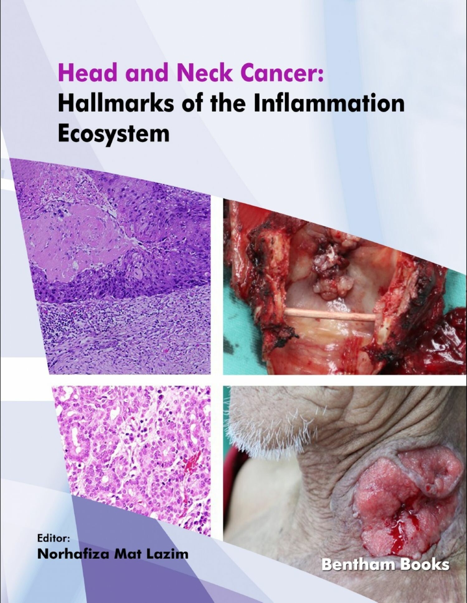 Cover Head and Neck Cancer: Hallmarks of the Inflammation Ecosystem