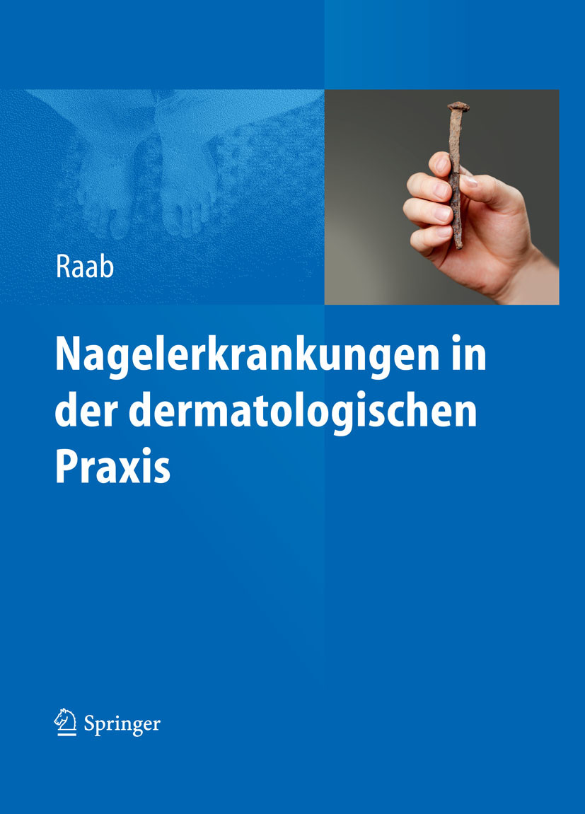 Cover Nagelerkrankungen in der dermatologischen Praxis