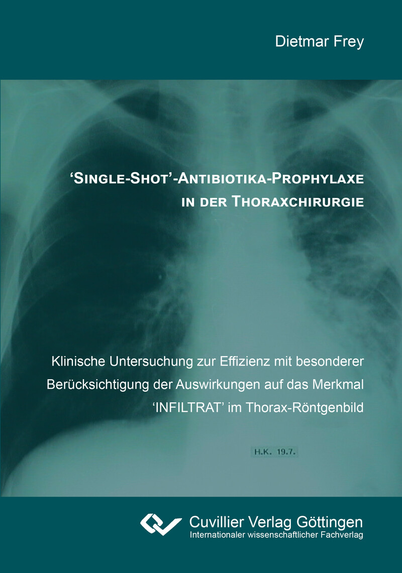 Cover 'Single-Shot'-Antibiotika-Prophylaxe in der Thoraxchirurgie