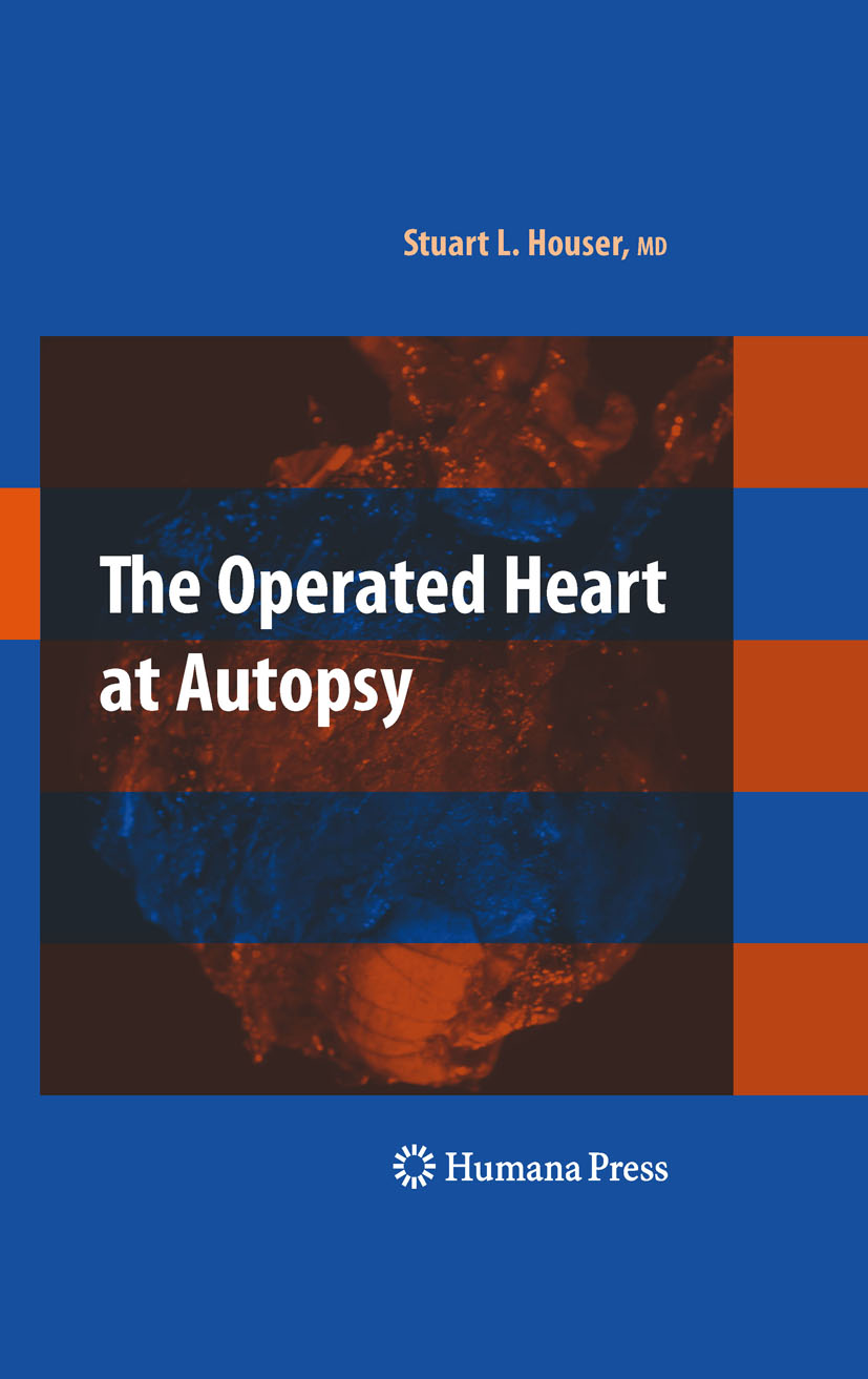 Cover The Operated Heart at Autopsy