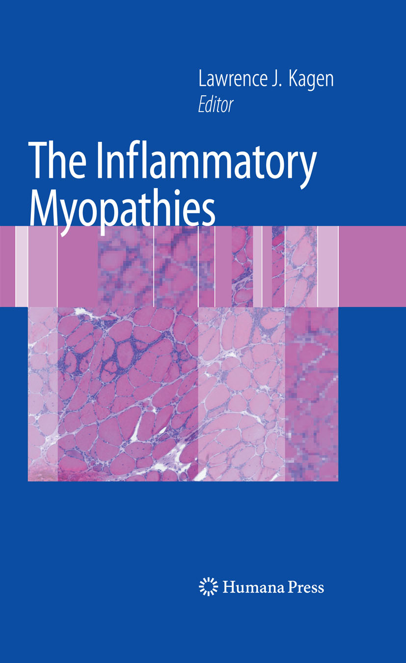 The Inflammatory Myopathies