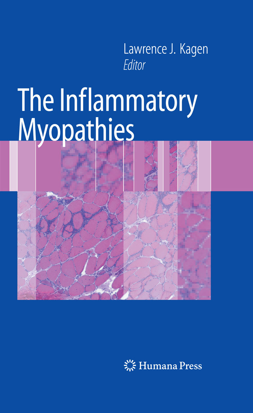 Cover The Inflammatory Myopathies