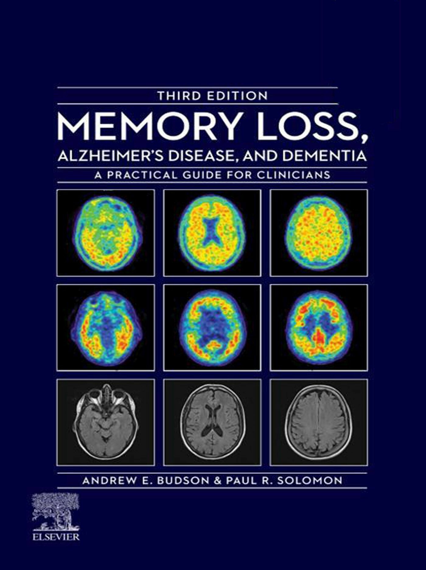 Cover Memory Loss, Alzheimer's Disease, and Dementia - E-Book