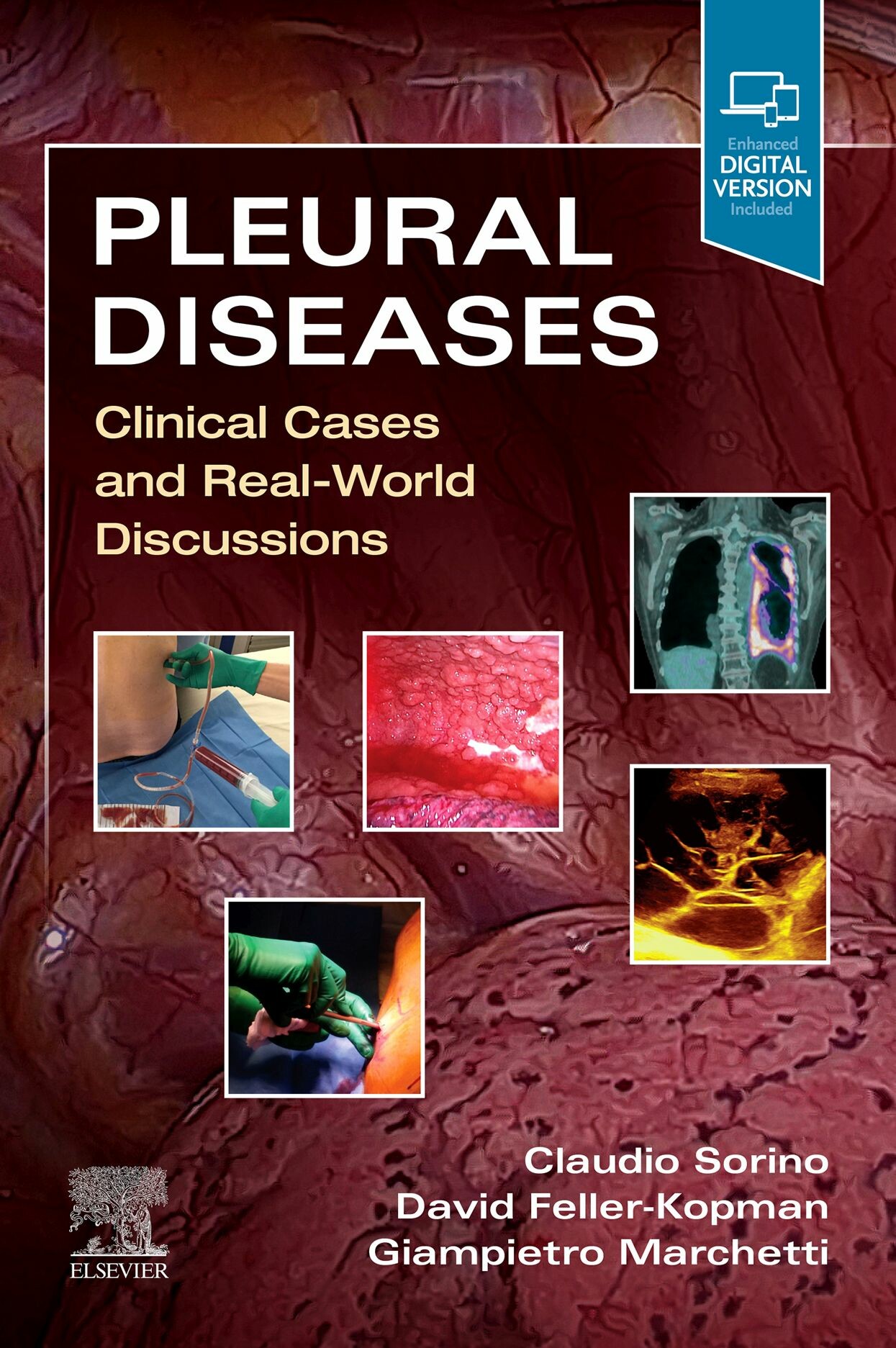 Cover Pleural Diseases,E-Book