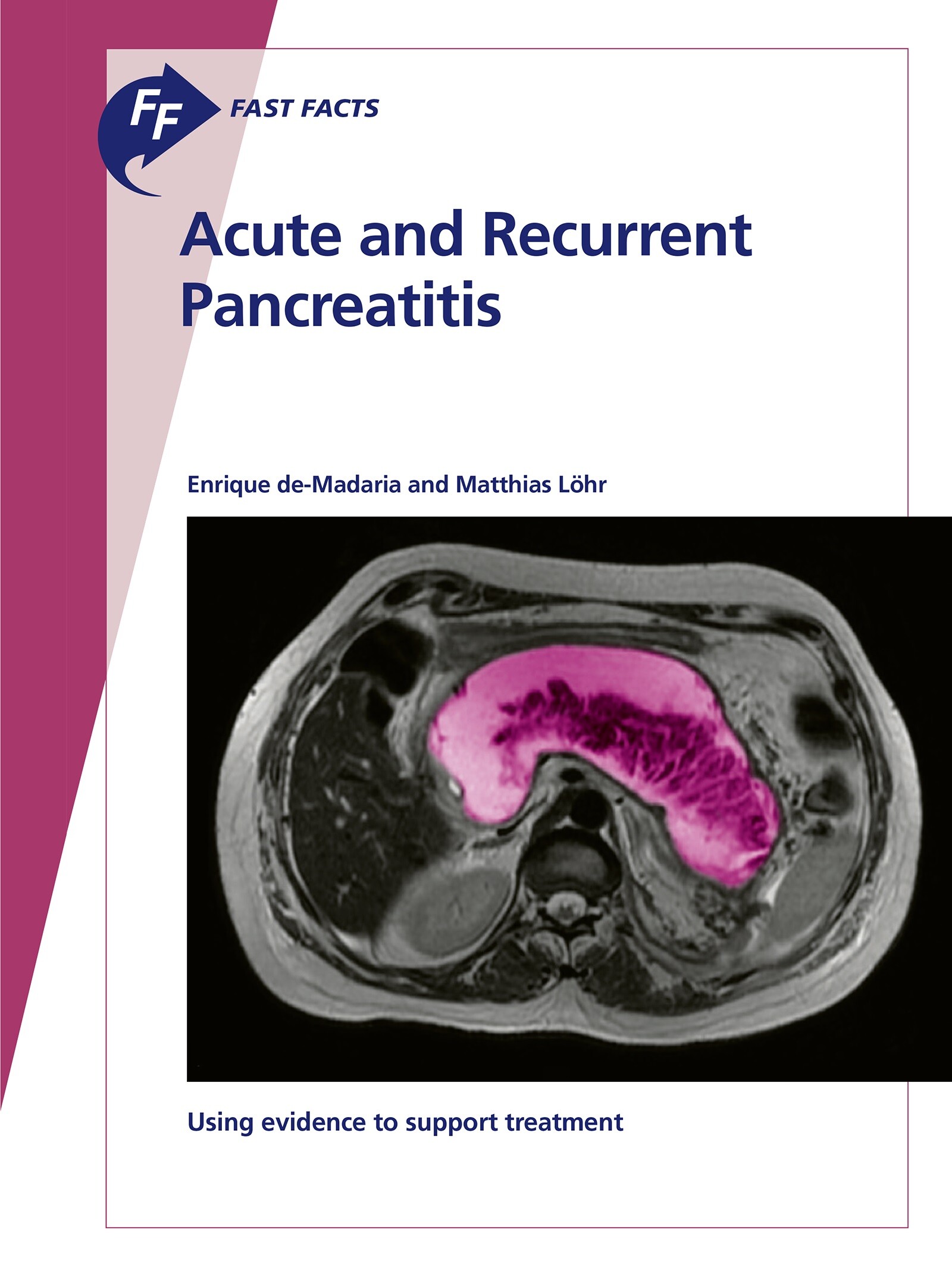 Cover Fast Facts: Acute and Recurrent Pancreatitis