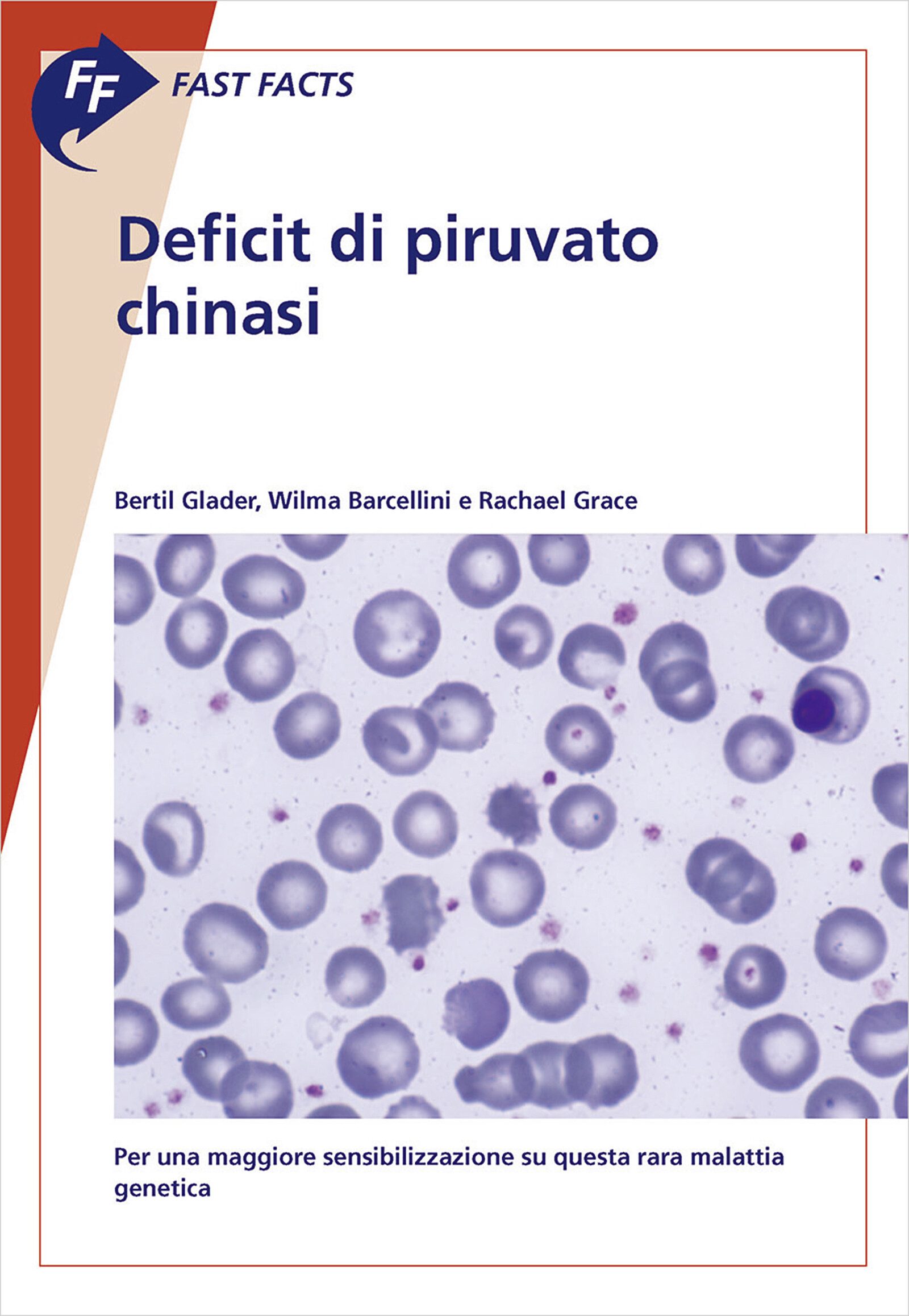 Cover Fast Facts: Deficit di piruvato chinasi