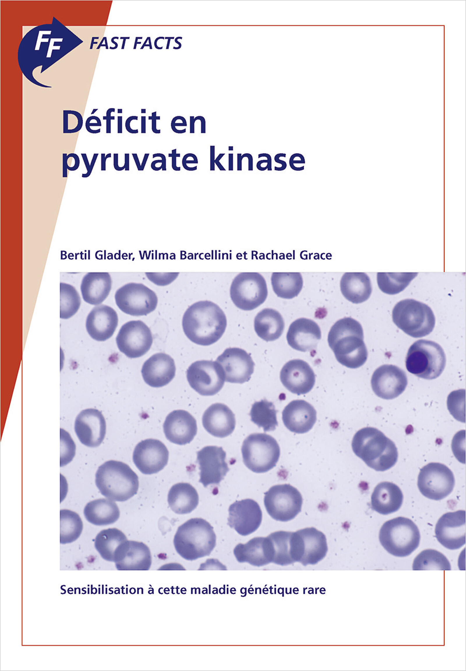 Cover Fast Facts: Déficit en pyruvate kinase