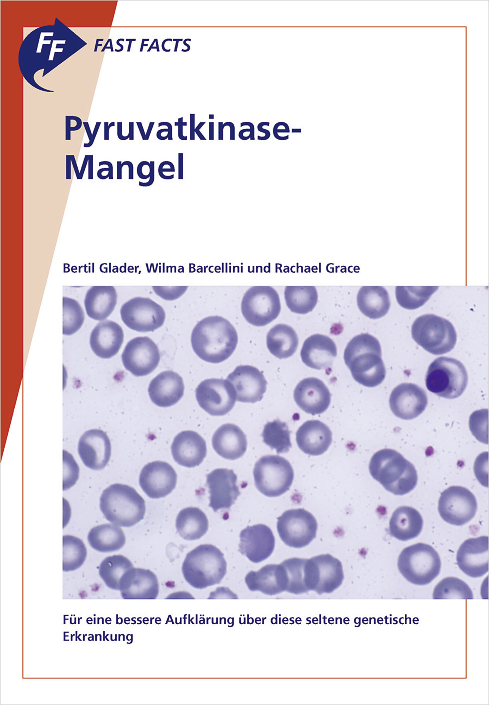 Fast Facts: Pyruvatkinase-Mangel
