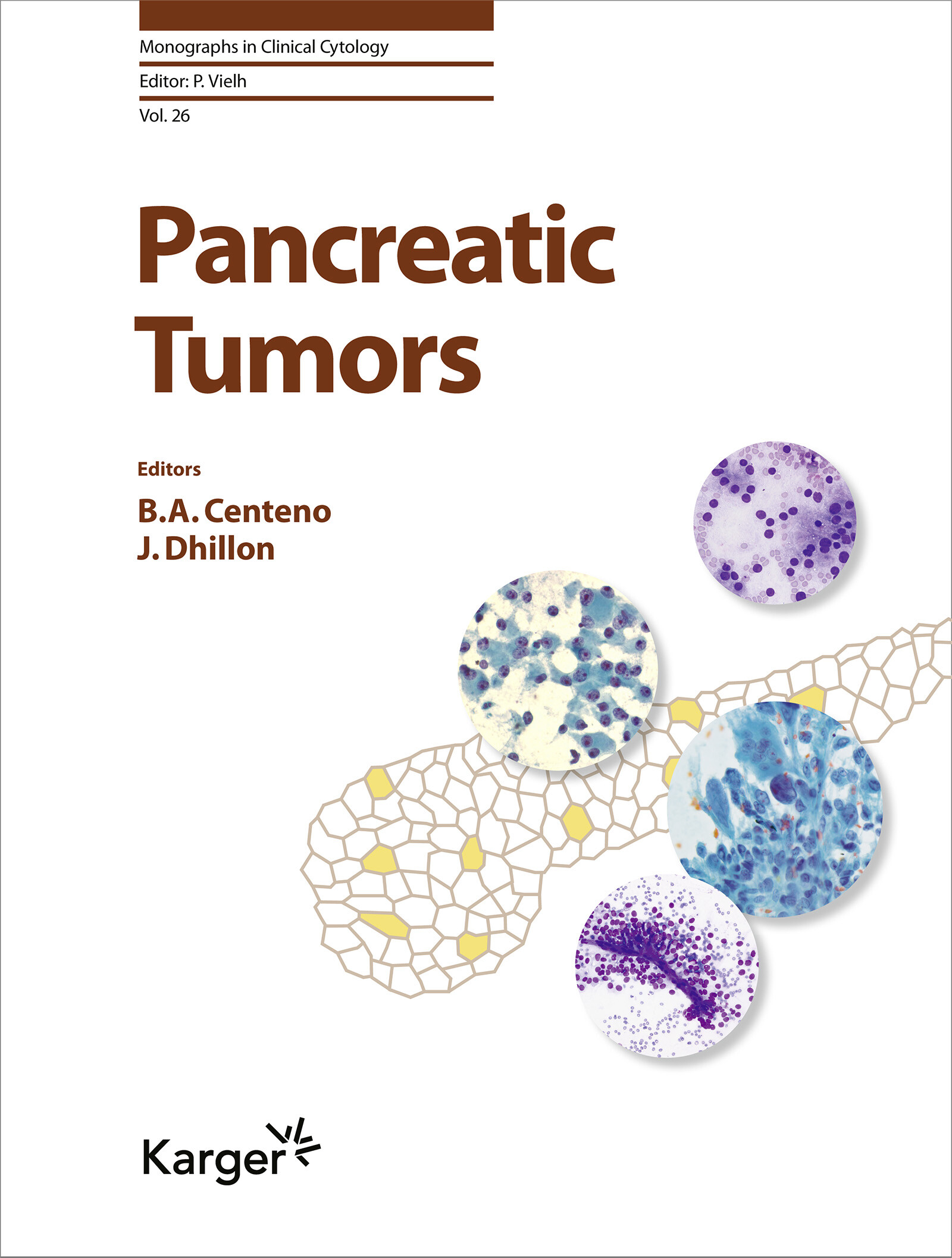 Cover Pancreatic Tumors