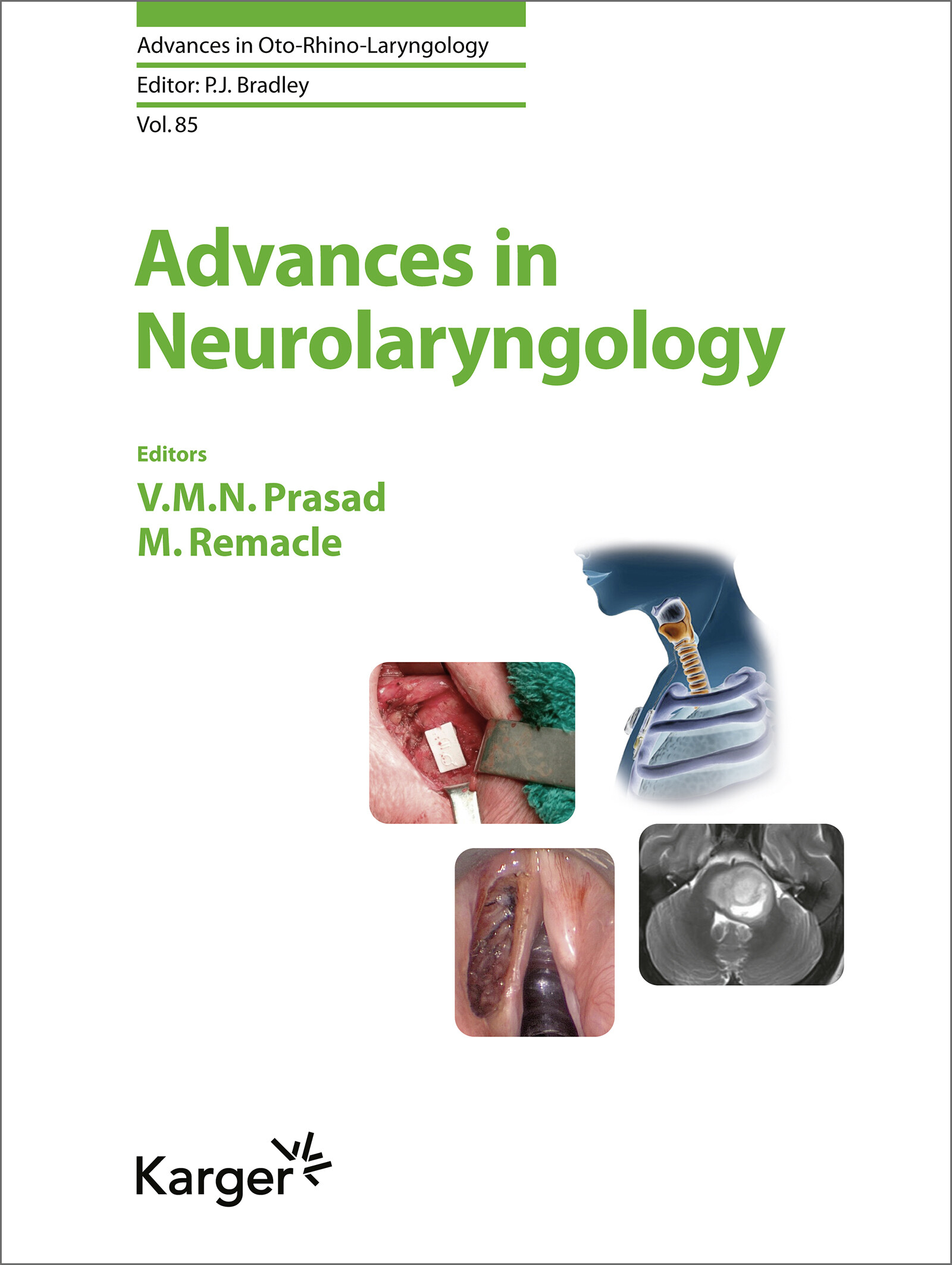 Cover Advances in Neurolaryngology
