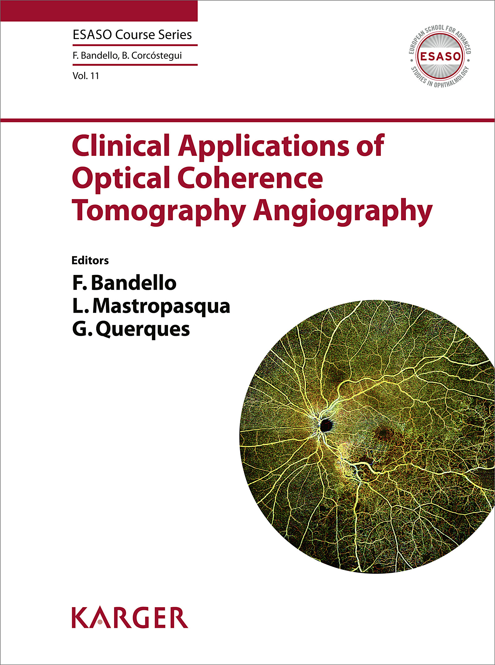 Clinical Applications of Optical Coherence Tomography Angiography EBook