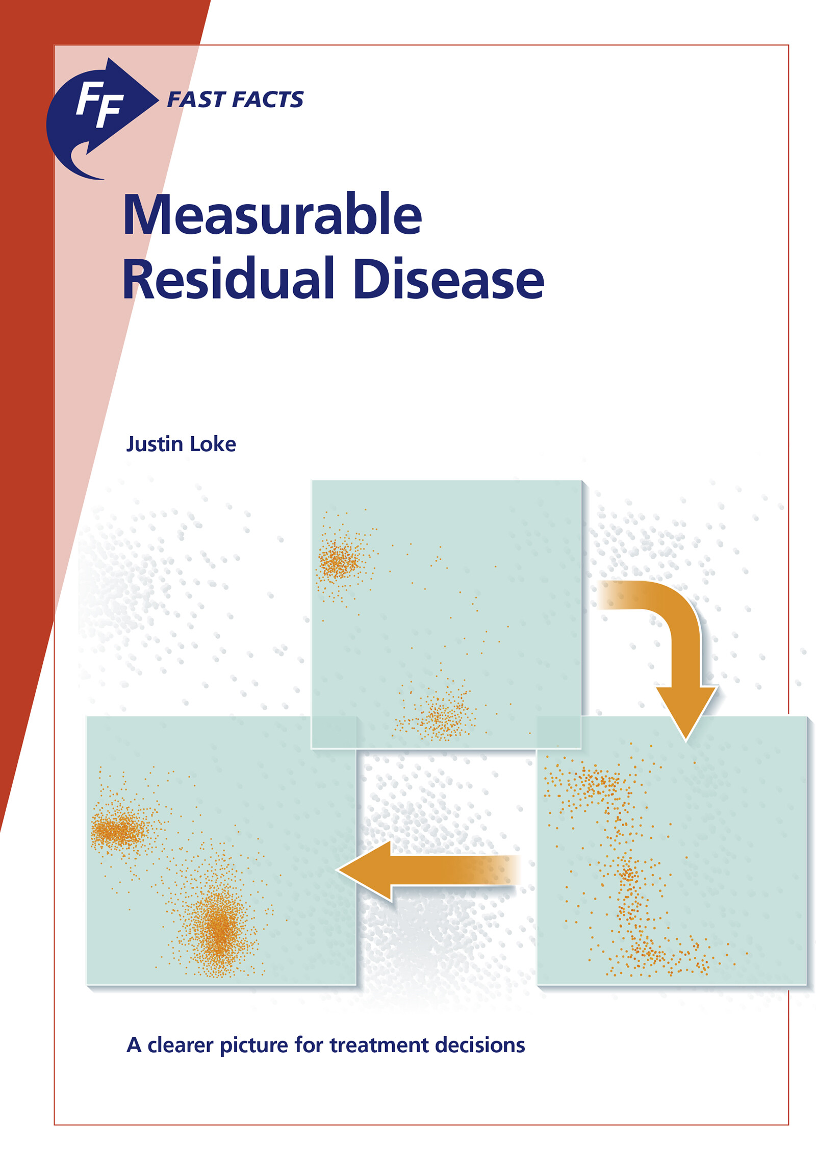 Fast Facts: Measurable Residual Disease