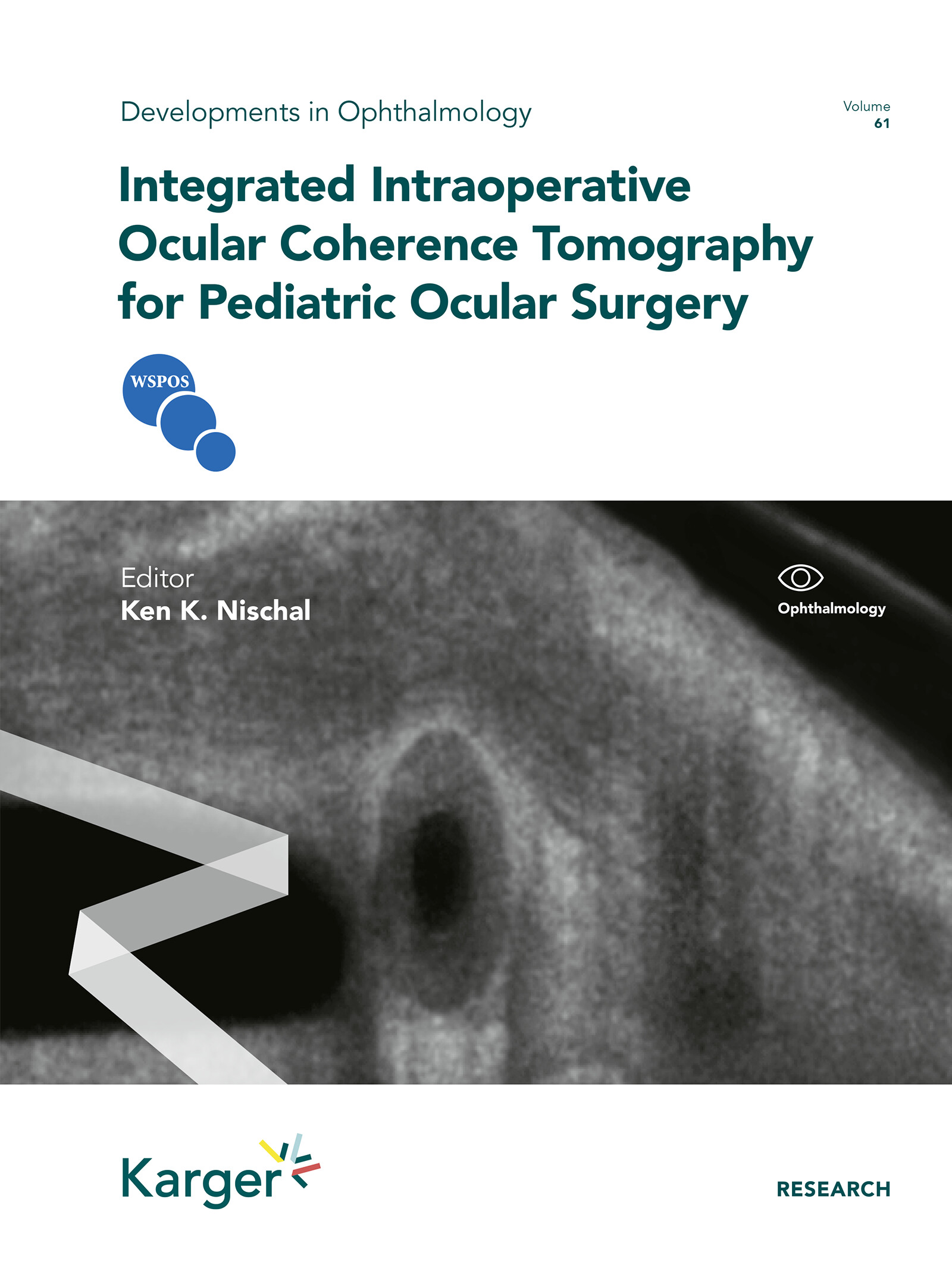 Cover Integrated Intraoperative Ocular Coherence Tomography for Pediatric Ocular Surgery